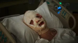 Tom Rhys Harries as Matt Hagen with bandaged face in hospital scene from Clayface 2026